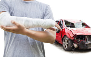 injured arm after a car accident