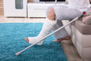 man with broken leg resting at home