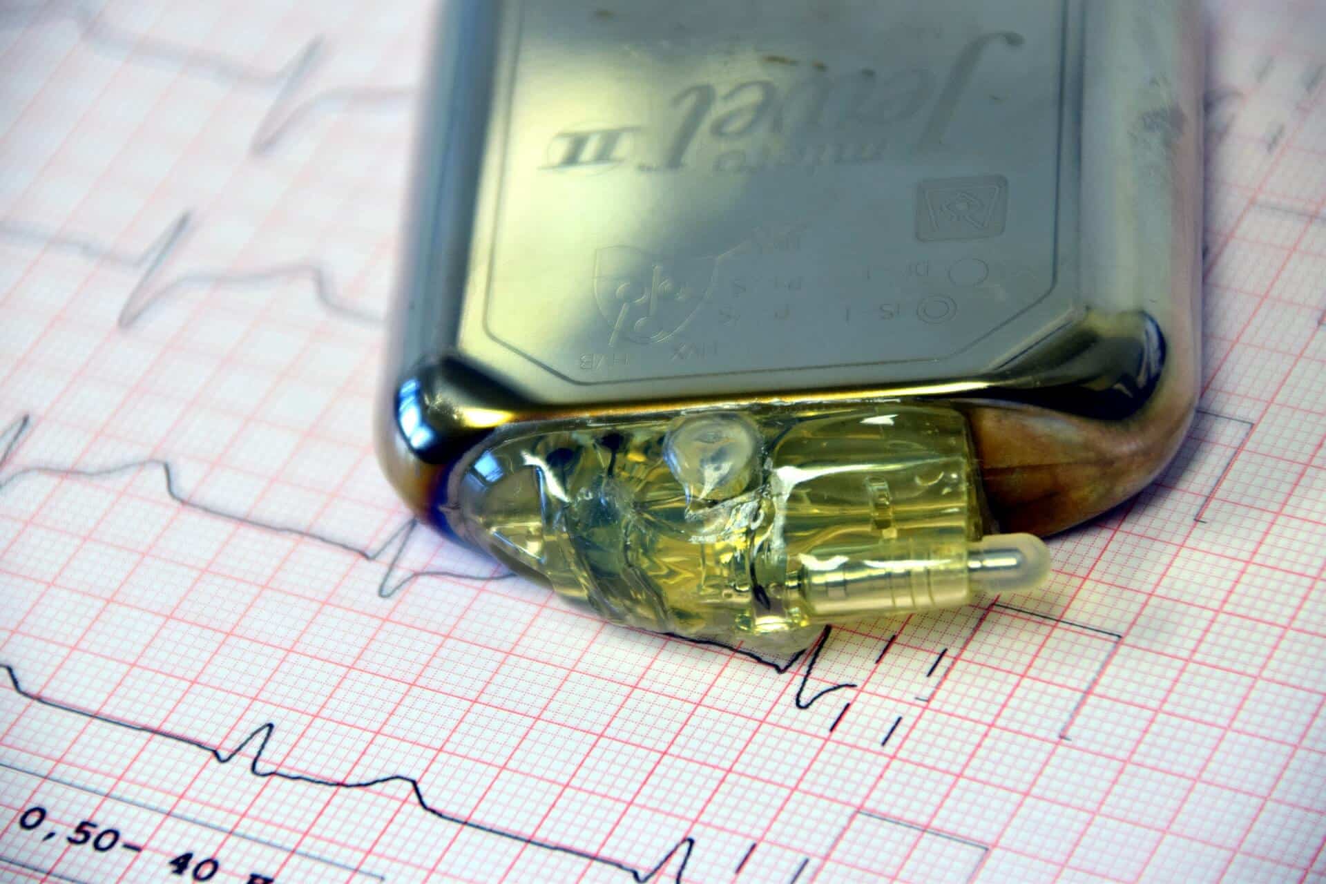 pension cigarette Staples ETFs Miss Out On Some Pension Help